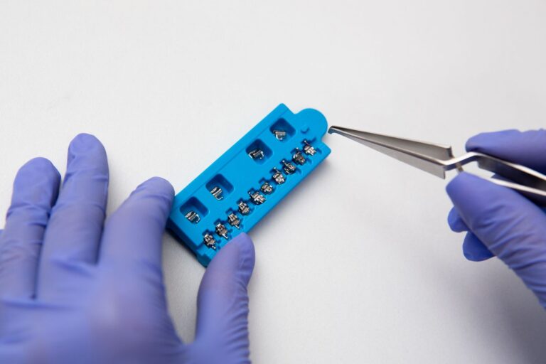 How to Clean Braces? A Daily Routine That Works